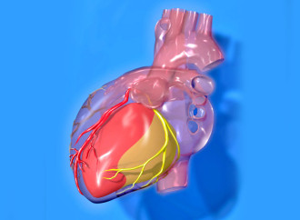 Guías acc/aha 2014 de sindrome coronario agudo sin supradesnivel del segmento st