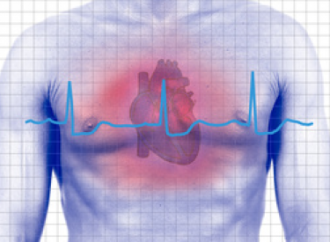 Aire vs Oxígeno en el Infarto agudo de miocardio con elevación del ST