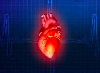 Salud Cardiovascular ideal y la prevalencia y severidad de la Estenosis Aórtica en  pacientes añosos