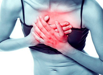 Infarto agudo del miocardio en las mujeres