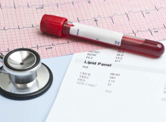 Guías ACC/AHA de lípidos: un paso adelante hacia el “colesterol 0”