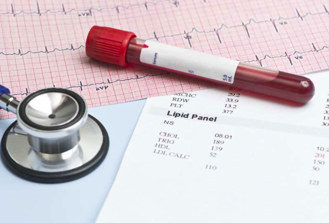 Guías ACC/AHA de lípidos: un paso adelante hacia el “colesterol 0”