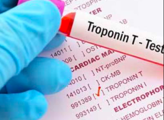¿Troponinitis?  Elevación de troponina en pacientes que no presentan un evento coronario