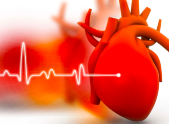 Criterios Ecocardiográficos simplificados para el diagnóstico y predicción de progresión de la Cardiopatía Reumática latente