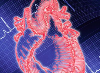 Shock Cardiogénico en Takotsubo vs Infarto Agudo de Miocardio
