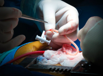 Arteria Radial vs Arteria mamaria interna derecha vs Vena safena como segundo conducto en cirugía de revascularización miocárdica Metanálisis de eventos clínicos