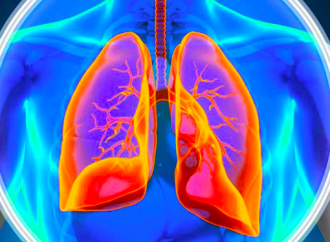 Actualización en hipertensión pulmonar tromboembólica crónica: