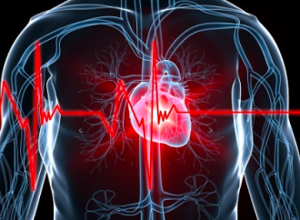 Cardiomiopatía isquémica
