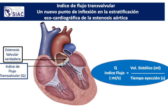 Un nuevo punto de inflexión en la estratificación eco-cardiográfica de la estenosis aórtica