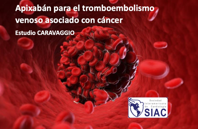 Apixabán para el tromboembolismo venoso asociado con cáncer