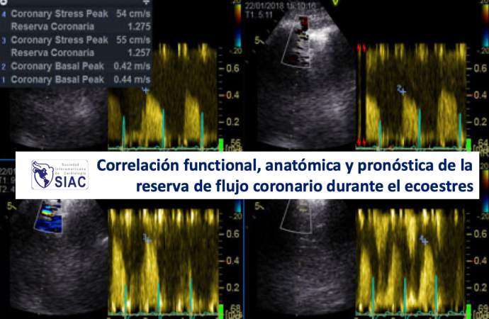Correlación functional, anatómica y pronóstica de la reserva de flujo coronario durante el ecoestres