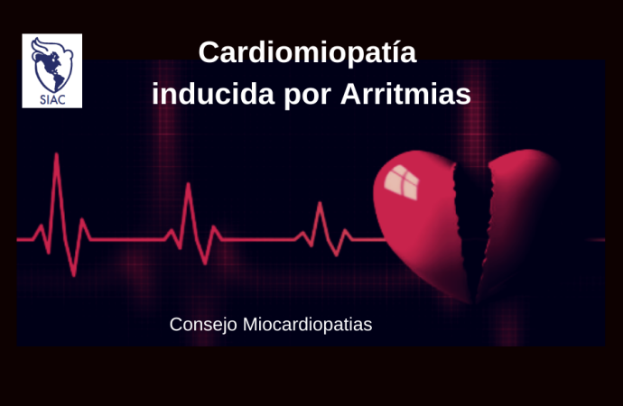 Cardiomiopatía inducida por Arritmias