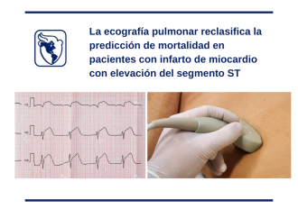 La ecografía pulmonar reclasifica la predicción de mortalidad en pacientes con infarto de miocardio con elevación del segmento ST