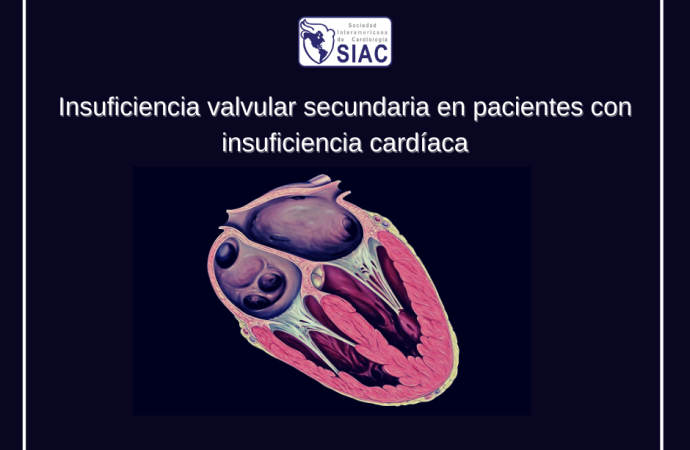Insuficiencia valvular secundaria en pacientes con insuficiencia cardíaca