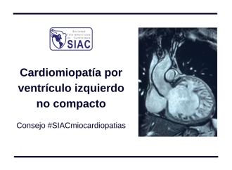 Cardiomiopatía por ventrículo izquierdo no compacto