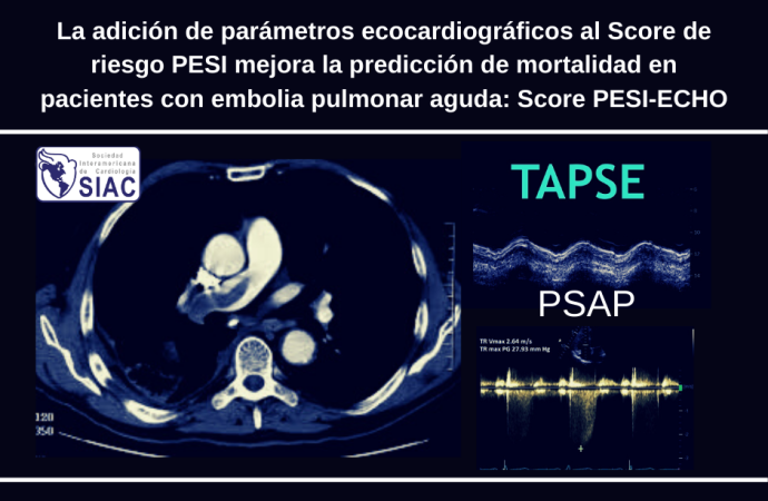 La adición de parámetros ecocardiográficos al Score de riesgo PESI mejora la predicción de mortalidad en pacientes con embolia pulmonar aguda: Score PESI-ECHO