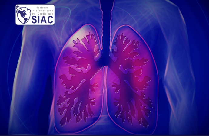 Manejo avanzado del Tromboembolismo de pulmón de riesgo intermedio alto