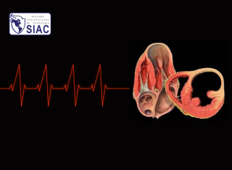 Terapias avanzadas para arritmias ventriculares en pacientes con cardiomiopatía chagásica