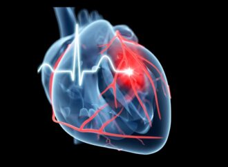 Miocarditis: ¿necesitamos actualizaciones más frecuentes?