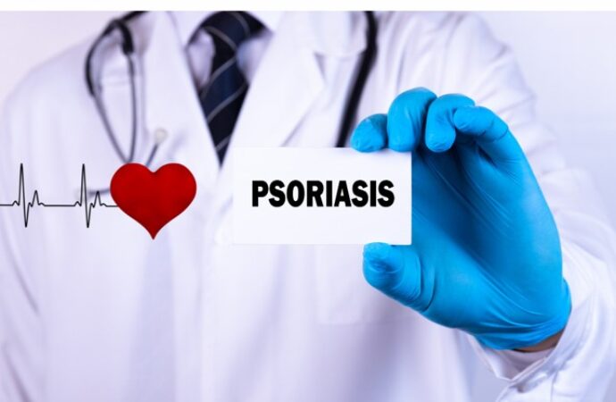 La Psoriasis ¿Puede generar enfermedad cardiovascular?